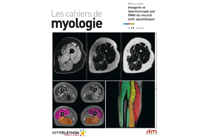 cahiers-myologie-n13-actu.png