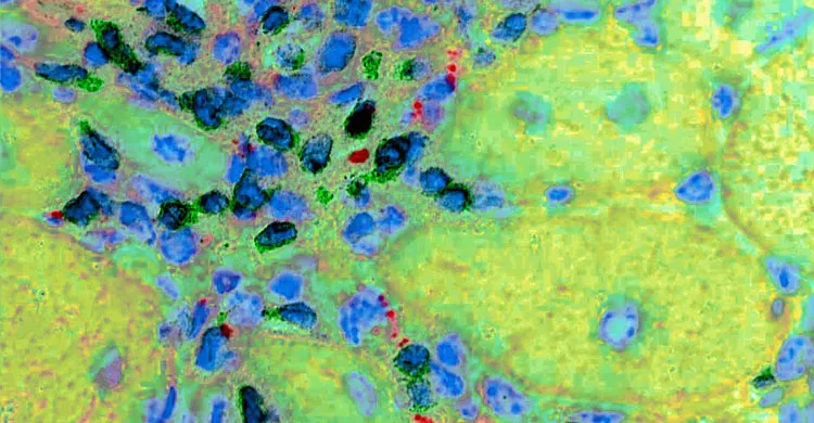 Vignette Les Cahiers de Myologie