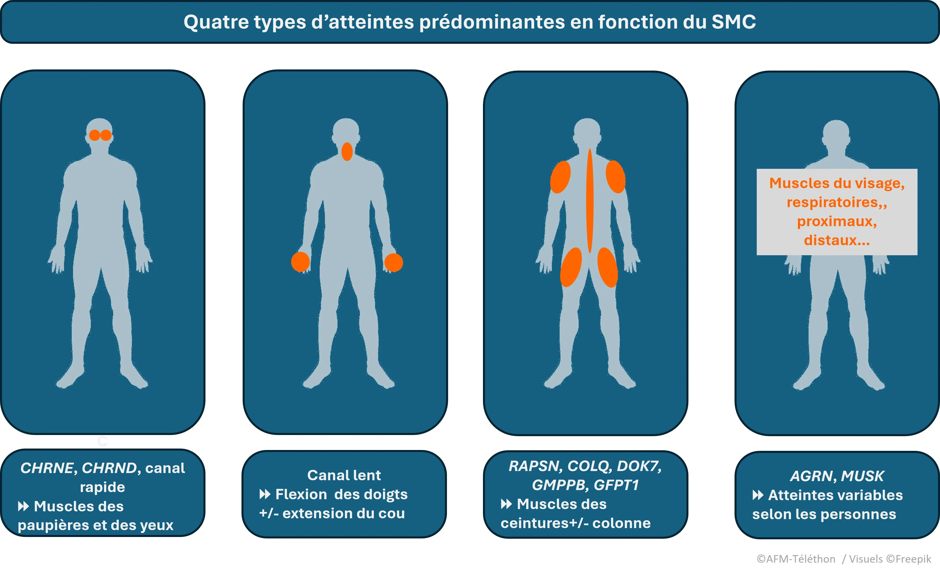 Infographie - Quatre types d'atteintes prédominantes en fonction du SMC